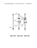 COMPOSITIONS, METHODS AND DEVICES FOR LOCAL DRUG DELIVERY diagram and image