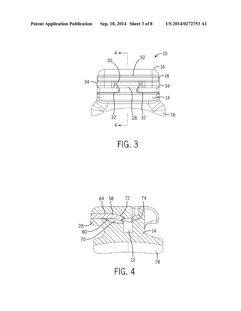 Self-Ligating Bracket - diagram, schematic, and image 04