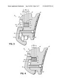 ORTHODONTIC ARCHWIRE diagram and image