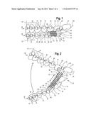 METHOD AND APPARATUS FOR TREATING MALOCCLUSIONS AND TEETH ALIGNMENT diagram and image