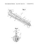 METHOD AND APPARATUS FOR TREATING MALOCCLUSIONS AND TEETH ALIGNMENT diagram and image