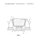 DEVICE FOR DENTAL, CLEANING, OR OTHER PROCEDURE diagram and image