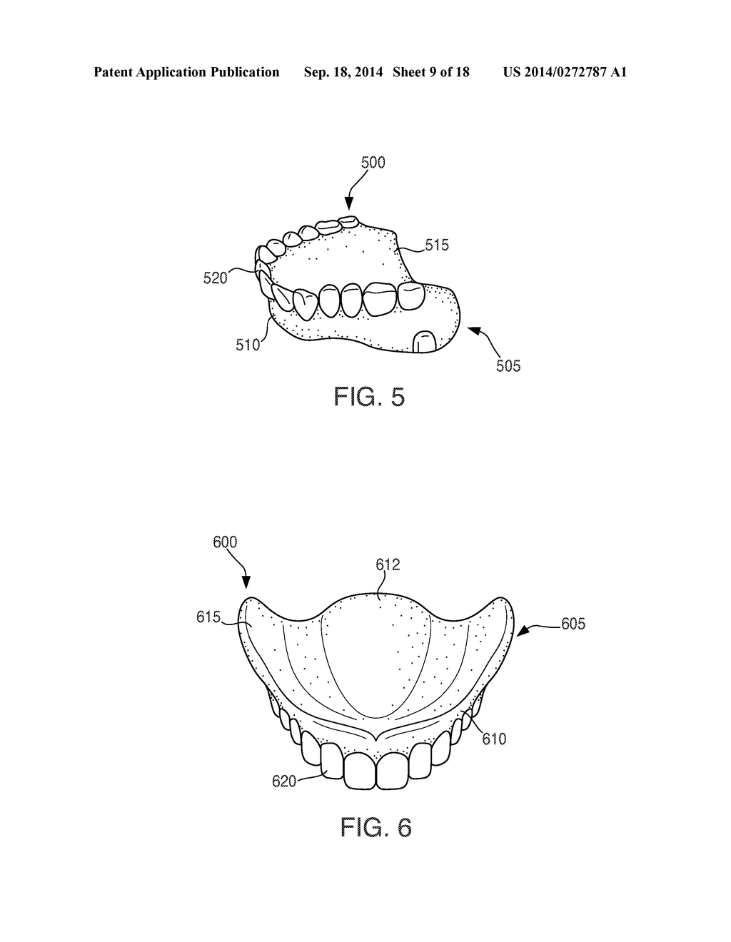 DENTAL DEVICES AND SYSTEMS AND METHODS FOR MAKING THE SAME - diagram, schematic, and image 10