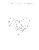 PATIENT MODELS FOR ORAL SURGERY diagram and image