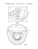 PATIENT MODELS FOR ORAL SURGERY diagram and image