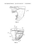 PATIENT MODELS FOR ORAL SURGERY diagram and image