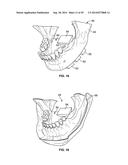 PATIENT MODELS FOR ORAL SURGERY diagram and image