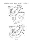 PATIENT MODELS FOR ORAL SURGERY diagram and image