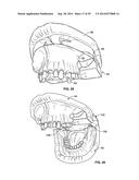 PATIENT MODELS FOR ORAL SURGERY diagram and image