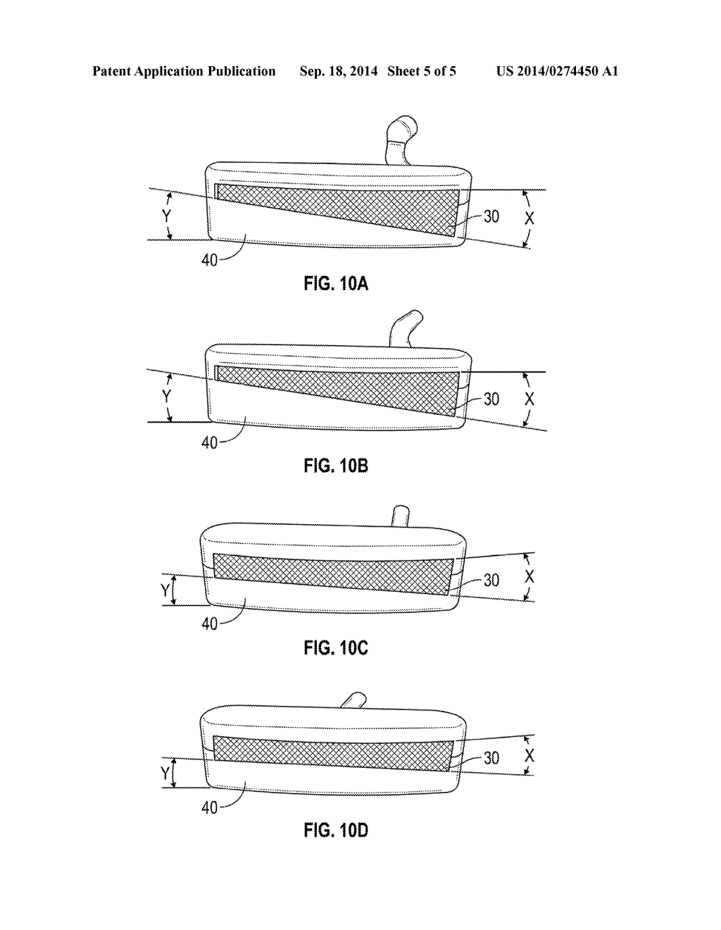 MULTIPLE MATERIAL PUTTER - diagram, schematic, and image 06