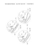 HIGH KNEES EXERCISE APPARATUS diagram and image