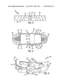 UNDULATING ROPE EXERCISE APPARATUS AND SYSTEM diagram and image