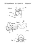 UNDULATING ROPE EXERCISE APPARATUS AND SYSTEM diagram and image