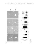 DESETHYLHYDROXYCHLOROQUINE FOR THE TREATMENT OF DISEASES ASSOCIATED WITH     INFLAMMATION diagram and image