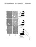 DESETHYLHYDROXYCHLOROQUINE FOR THE TREATMENT OF DISEASES ASSOCIATED WITH     INFLAMMATION diagram and image