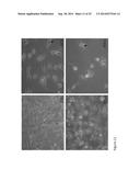 DESETHYLHYDROXYCHLOROQUINE FOR THE TREATMENT OF DISEASES ASSOCIATED WITH     INFLAMMATION diagram and image