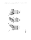 DESETHYLHYDROXYCHLOROQUINE FOR THE TREATMENT OF DISEASES ASSOCIATED WITH     INFLAMMATION diagram and image