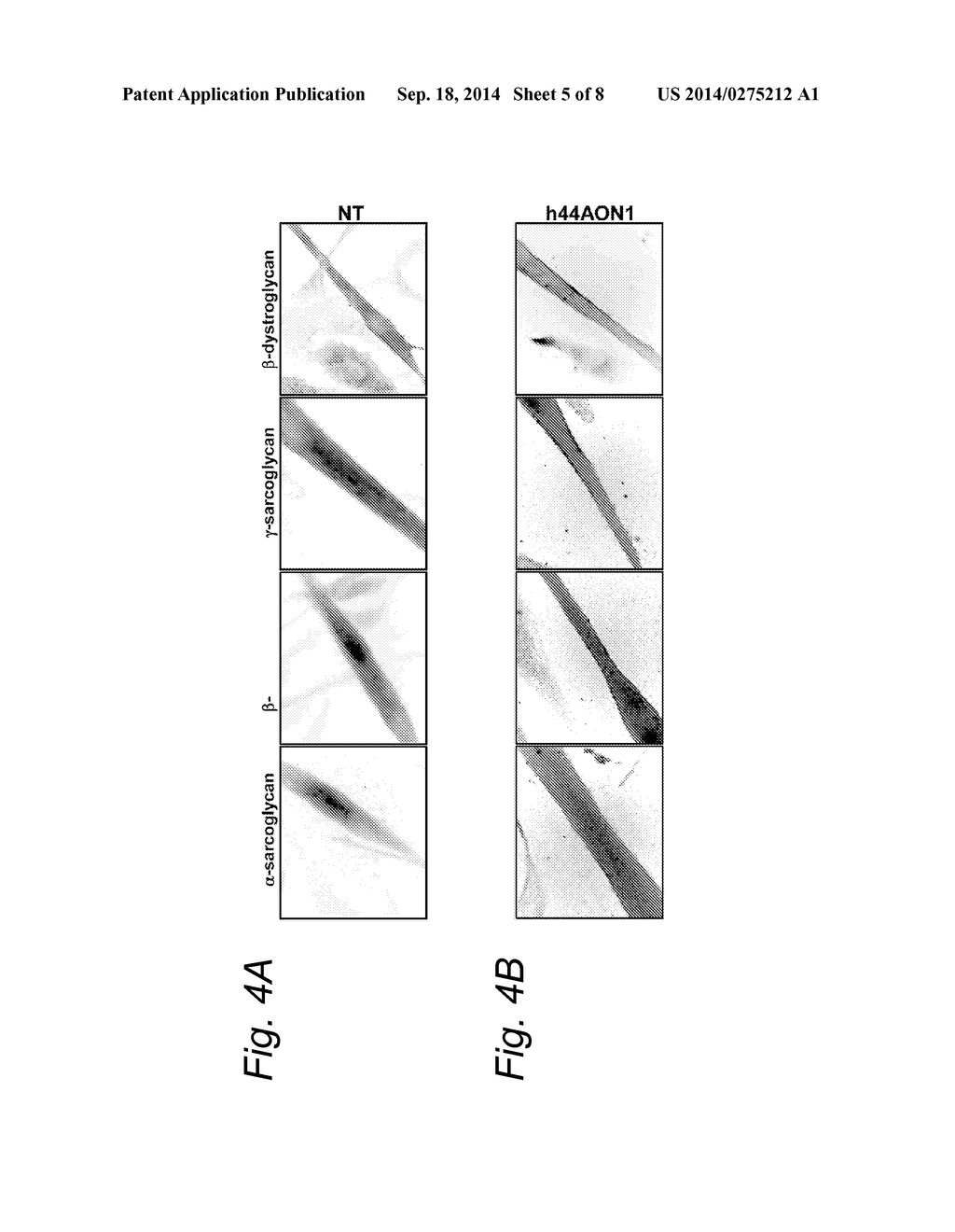 MODULATION OF EXON RECOGNITION IN PRE-MRNA BY INTERFERING WITH THE     SECONDARY RNA STRUCTURE - diagram, schematic, and image 06