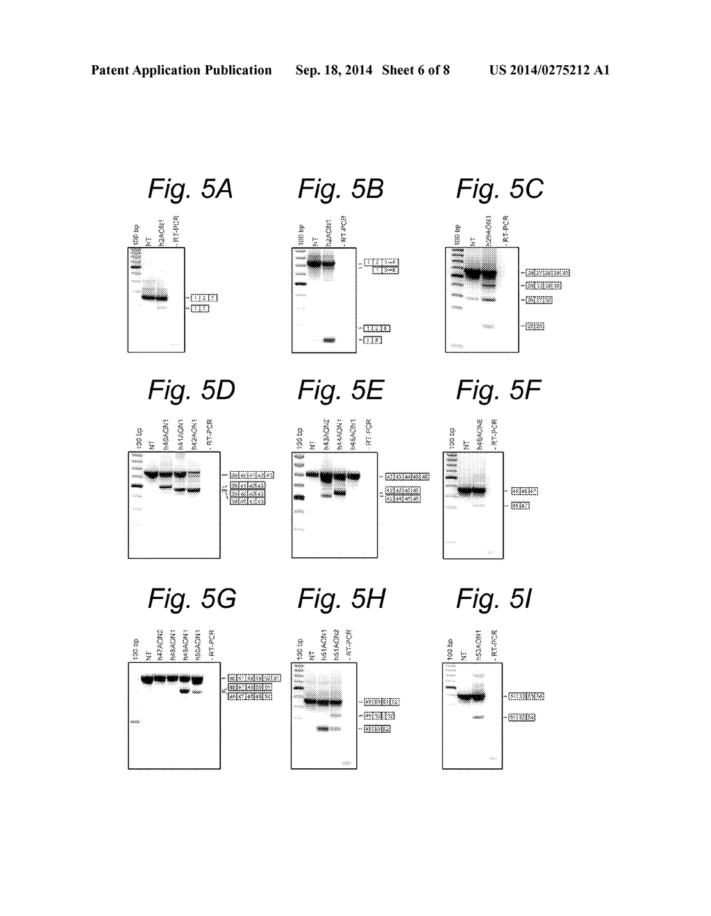 MODULATION OF EXON RECOGNITION IN PRE-MRNA BY INTERFERING WITH THE     SECONDARY RNA STRUCTURE - diagram, schematic, and image 07