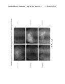 CHIMERIC PROMOTER FOR CONE PHOTORECEPTOR TARGETED GENE THERAPY diagram and image