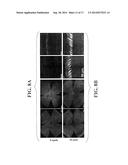 CHIMERIC PROMOTER FOR CONE PHOTORECEPTOR TARGETED GENE THERAPY diagram and image