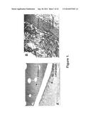 BIOCOMPATIBLE AND BIOABSORBABLE DERIVATIZED CHITOSAN COMPOSITIONS diagram and image