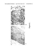 BIOCOMPATIBLE AND BIOABSORBABLE DERIVATIZED CHITOSAN COMPOSITIONS diagram and image