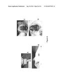 BIOCOMPATIBLE AND BIOABSORBABLE DERIVATIZED CHITOSAN COMPOSITIONS diagram and image