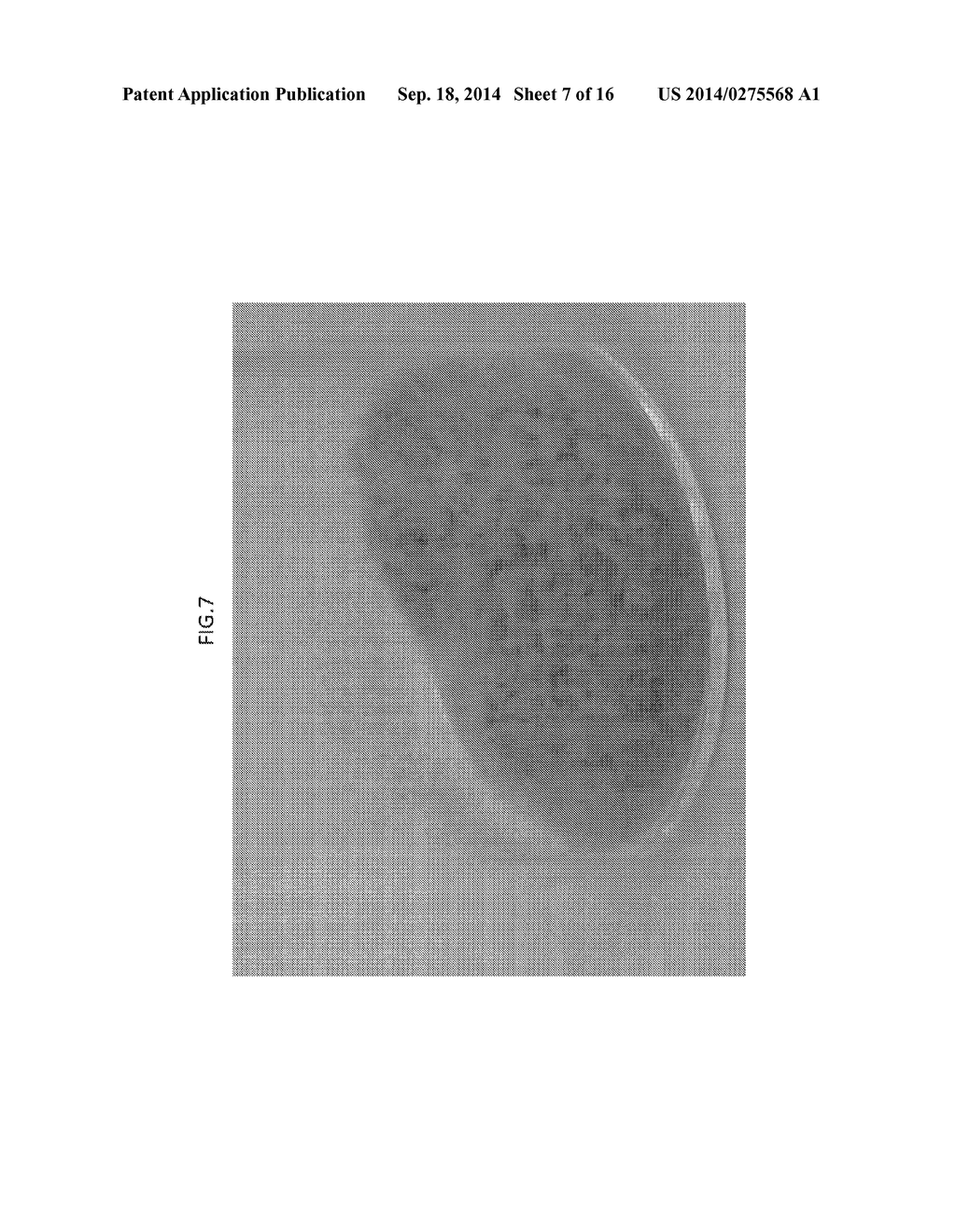 CRYSTAL OF 5-HYDROXY-1H-IMIDAZOLE-4-CARBOXAMIDE 3/4 HYDRATE, METHOD FOR     PRODUCING THE SAME AND CRYSTAL OF 5-HYDROXY-1H-IMIDAZOLE-4-CARBOXAMIDE     HYDRATE - diagram, schematic, and image 08