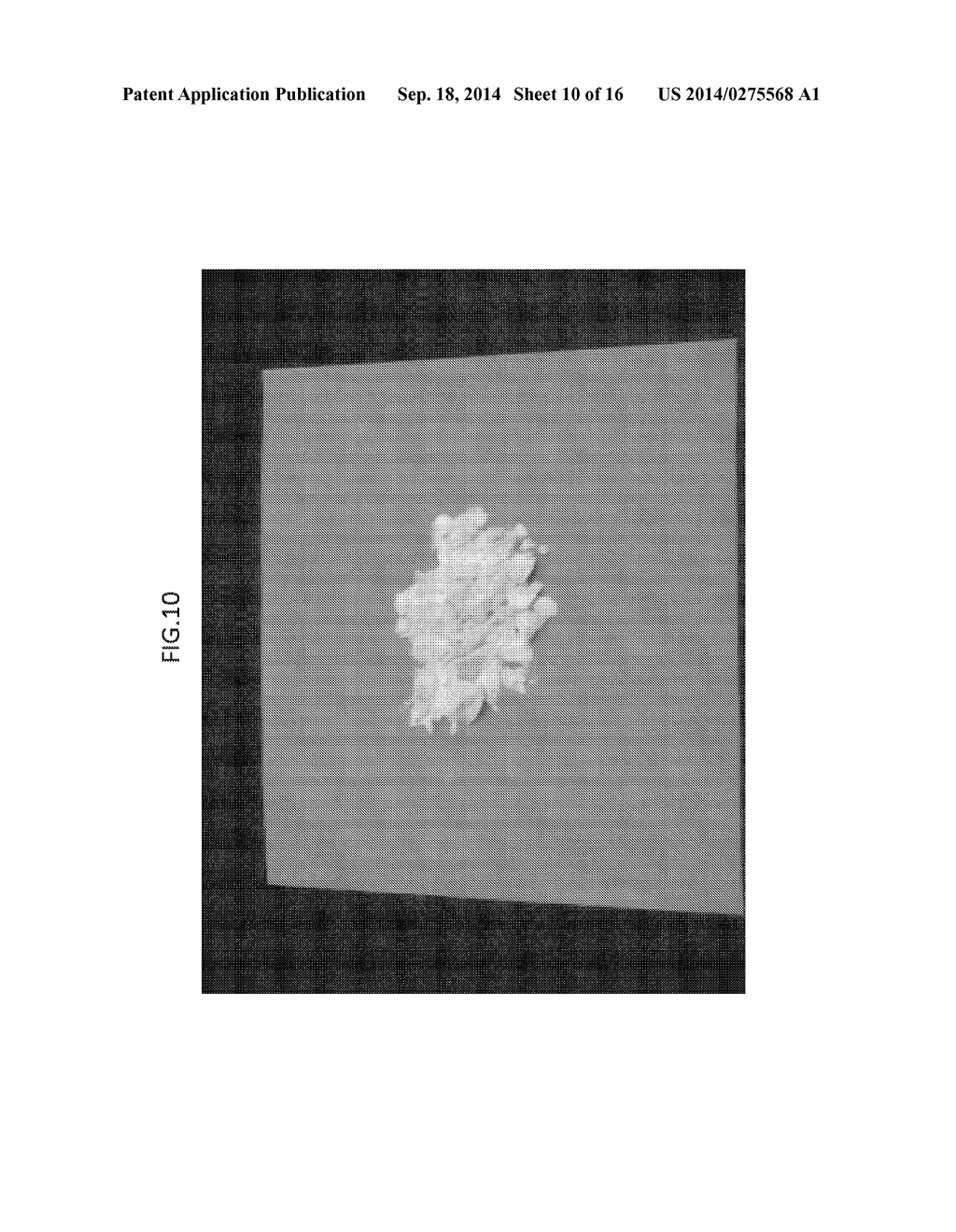 CRYSTAL OF 5-HYDROXY-1H-IMIDAZOLE-4-CARBOXAMIDE 3/4 HYDRATE, METHOD FOR     PRODUCING THE SAME AND CRYSTAL OF 5-HYDROXY-1H-IMIDAZOLE-4-CARBOXAMIDE     HYDRATE - diagram, schematic, and image 11