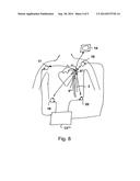 MEDICAL PRODUCT COMPRISING A FUNCTIONAL ELEMENT FOR THE INVASIVE USE IN A     PATIENT  diagram and image