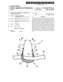 Structural support incorporating multiple strands diagram and image