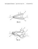 Structural support incorporating multiple strands diagram and image