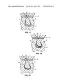 Structural support incorporating multiple strands diagram and image