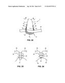 Structural support incorporating multiple strands diagram and image