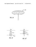 Devices, Systems and Methods for Treating Benign Prostatic Hyperplasia and     Other Conditions diagram and image