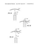 Devices, Systems and Methods for Treating Benign Prostatic Hyperplasia and     Other Conditions diagram and image