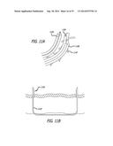 Devices, Systems and Methods for Treating Benign Prostatic Hyperplasia and     Other Conditions diagram and image