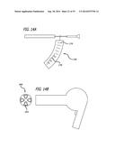 Devices, Systems and Methods for Treating Benign Prostatic Hyperplasia and     Other Conditions diagram and image