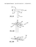 Devices, Systems and Methods for Treating Benign Prostatic Hyperplasia and     Other Conditions diagram and image