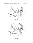 Translation Catheters, Systems, and Methods of Use Thereof diagram and image