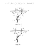 Translation Catheters, Systems, and Methods of Use Thereof diagram and image