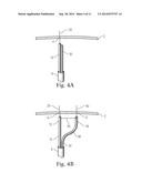 Translation Catheters, Systems, and Methods of Use Thereof diagram and image