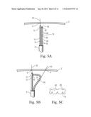 Translation Catheters, Systems, and Methods of Use Thereof diagram and image