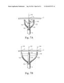 Translation Catheters, Systems, and Methods of Use Thereof diagram and image