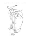 Resector Balloon Catheter With Multi-Port Hub diagram and image