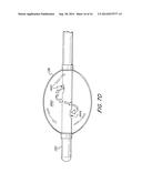 Resector Balloon Catheter With Multi-Port Hub diagram and image