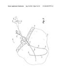 Flexible Shaft with Multiple Flexible Portions diagram and image