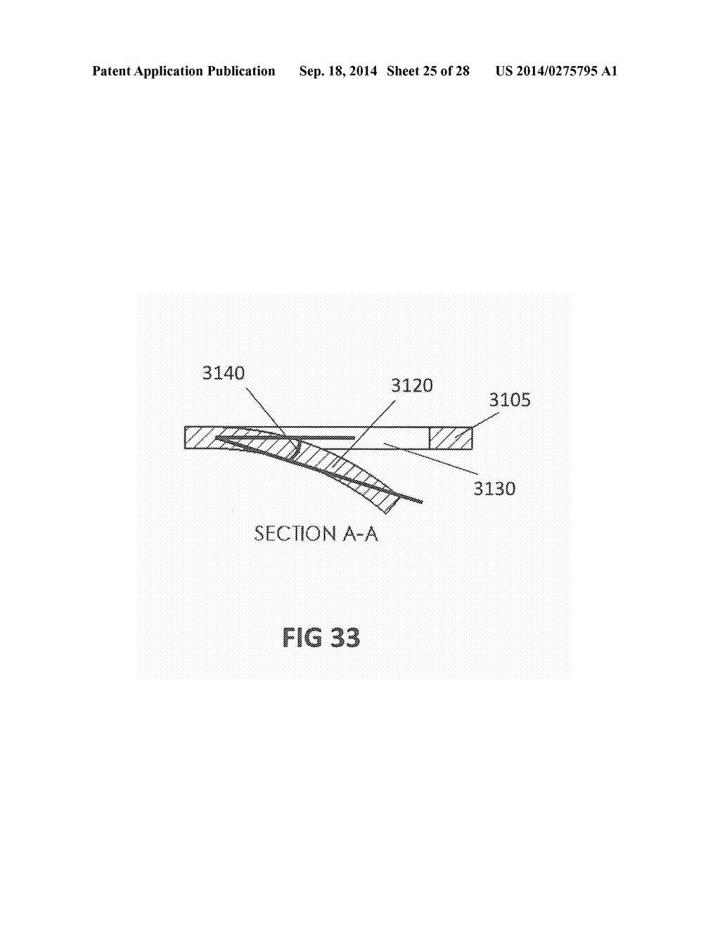 ACCESS DEVICE WITH VARIABLE LUMEN - diagram, schematic, and image 26