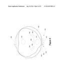 Multiple Sensors for Monitoring Health and Wellness of an Animal diagram and image